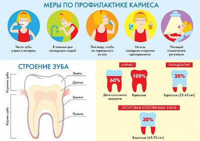 Кариес и его профилактика