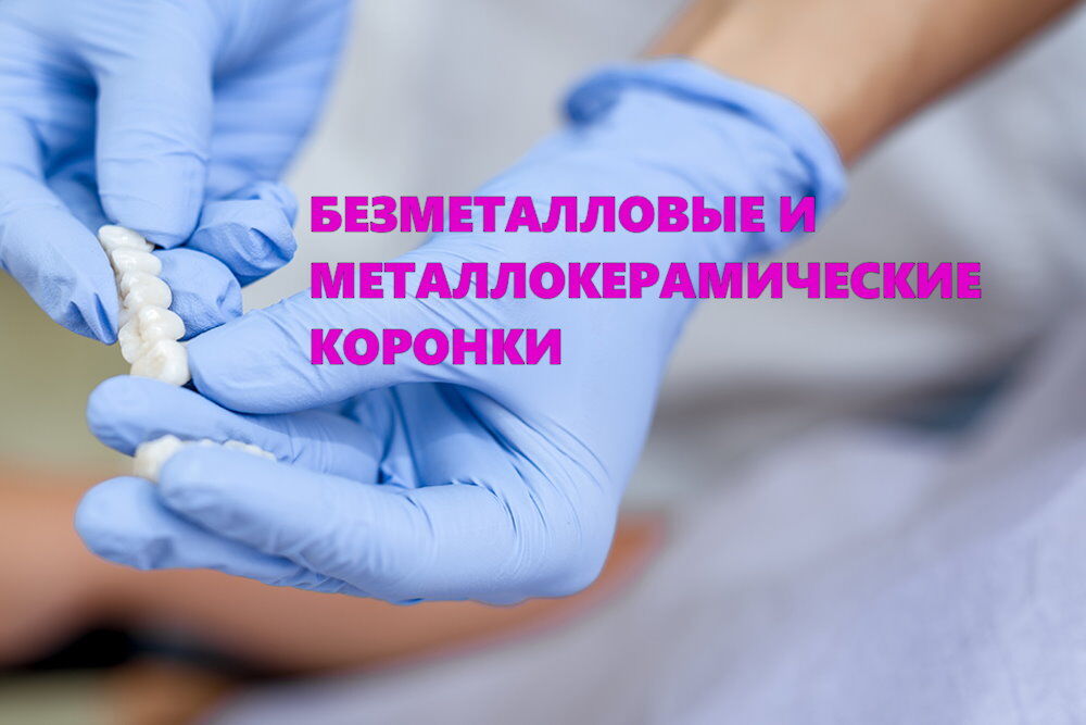 Безметалеві та металокерамічні коронки