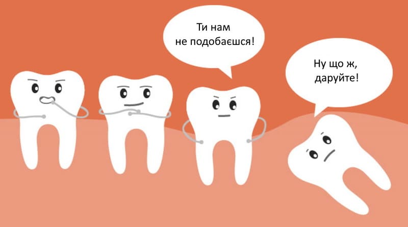 Видалення зуба