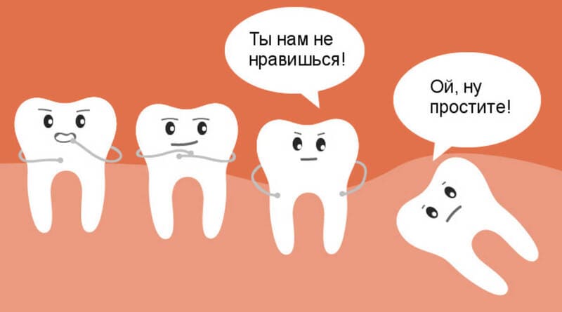 Удаление зуба